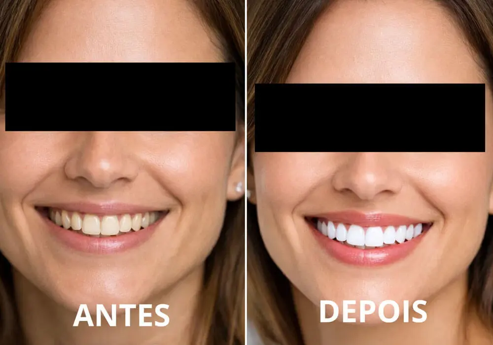 Antes e Depois